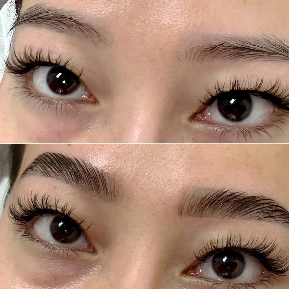 Before and after results of eyebrow growth using QUABROW Advanced Eyebrow Serum – visibly fuller, thicker, and more defined brows