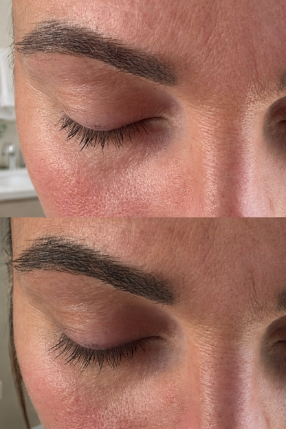 Activating Peptide Eyelash Serum – Prostaglandin-Free